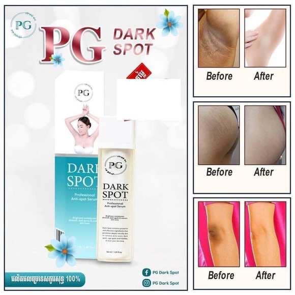 PG Dark Spot Whitening Serum 50ML - Picture 6 of 8